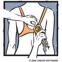 Female subscapular fat caliper site